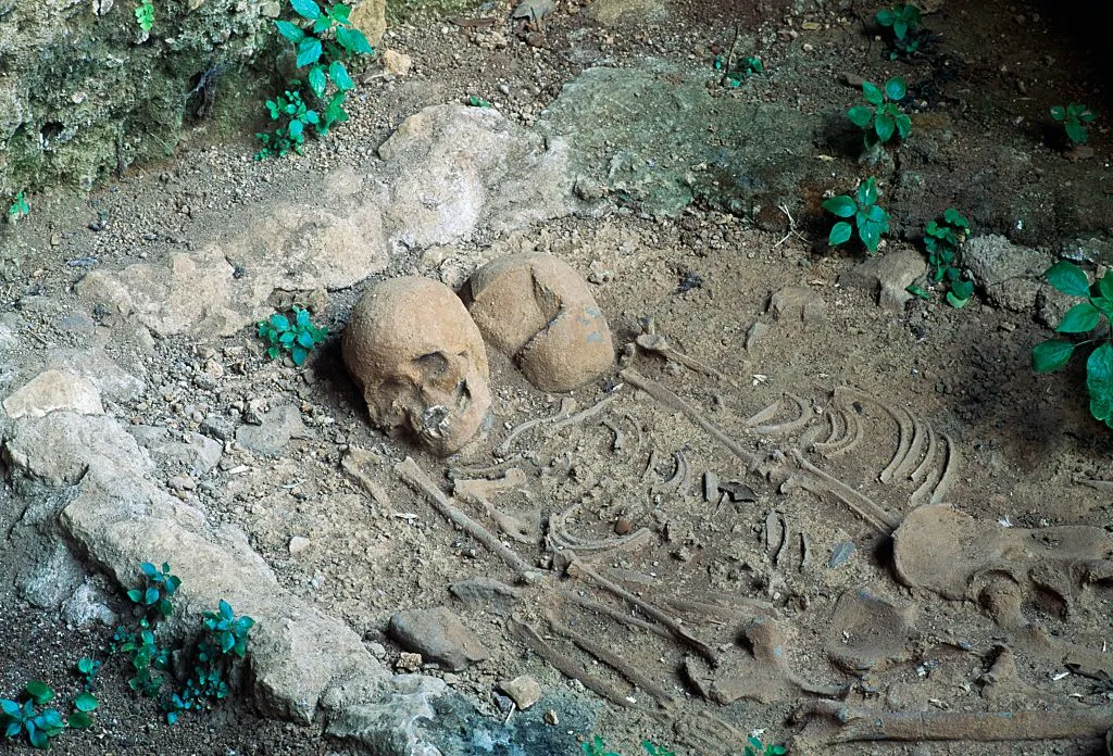 Oude omhelzing onthult zeldzame genetische ziekte